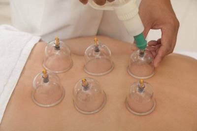 (Wet) Cupping